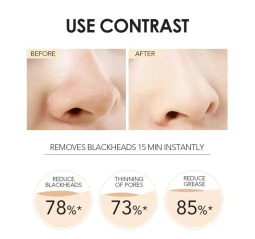 OTO COSMETICS Blackhead Removal Charcoal Mask  - ( Upto 90% Off )
